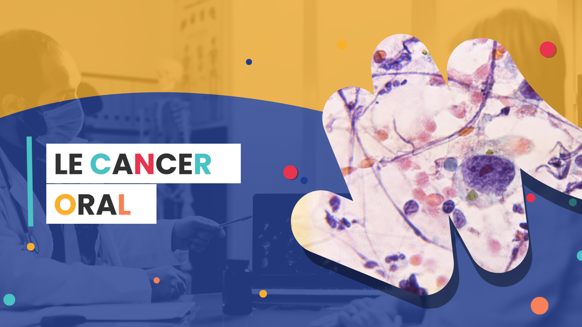 Le cancer oral