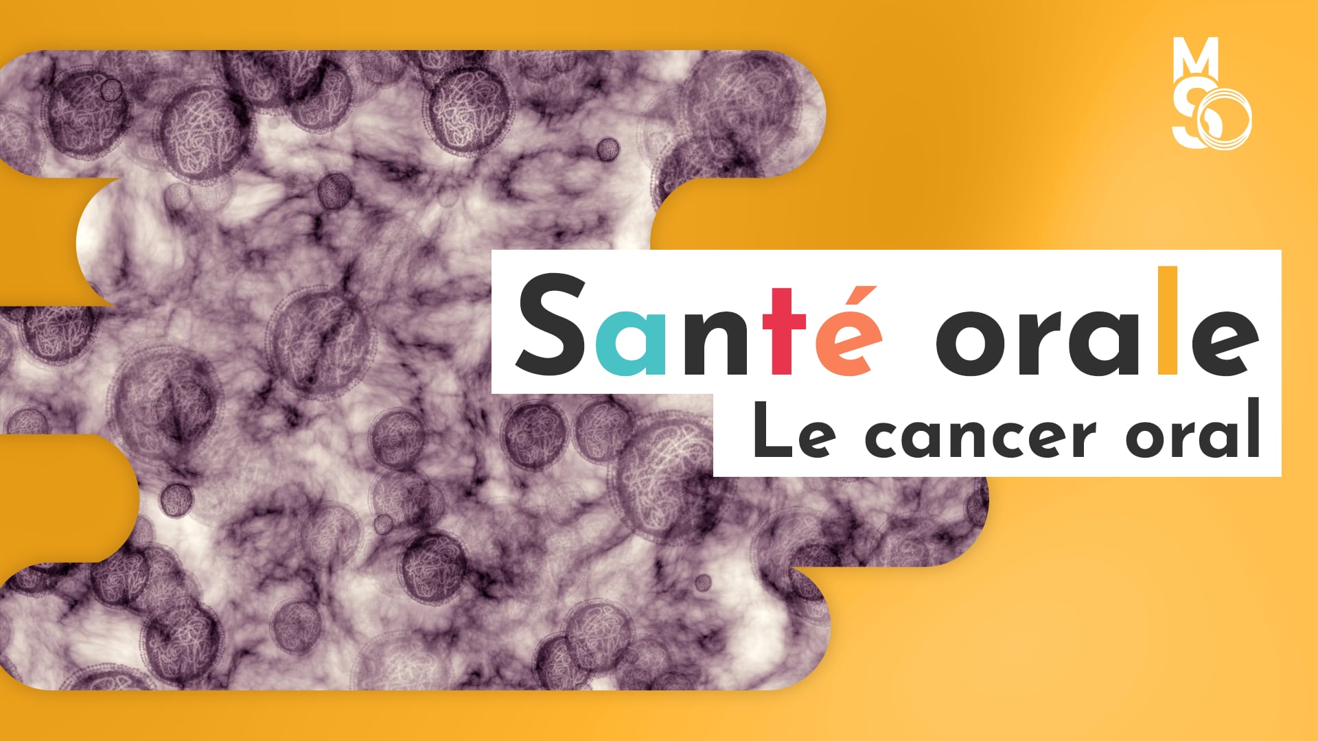 Le cancer oral